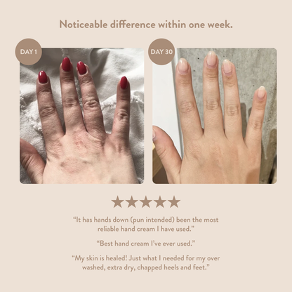 Overnight Hand & Foot Hydration Mask: 1oz